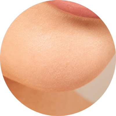 Chin filler