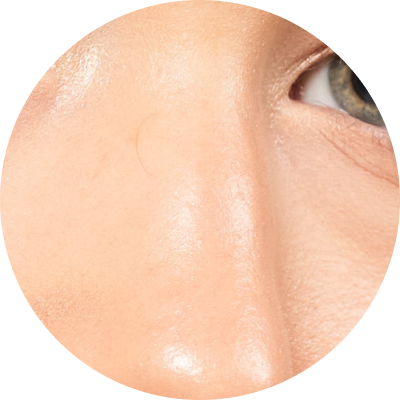 Nose tip lift