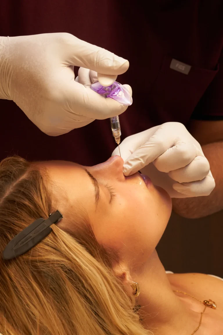 Arts zet een lipfiller